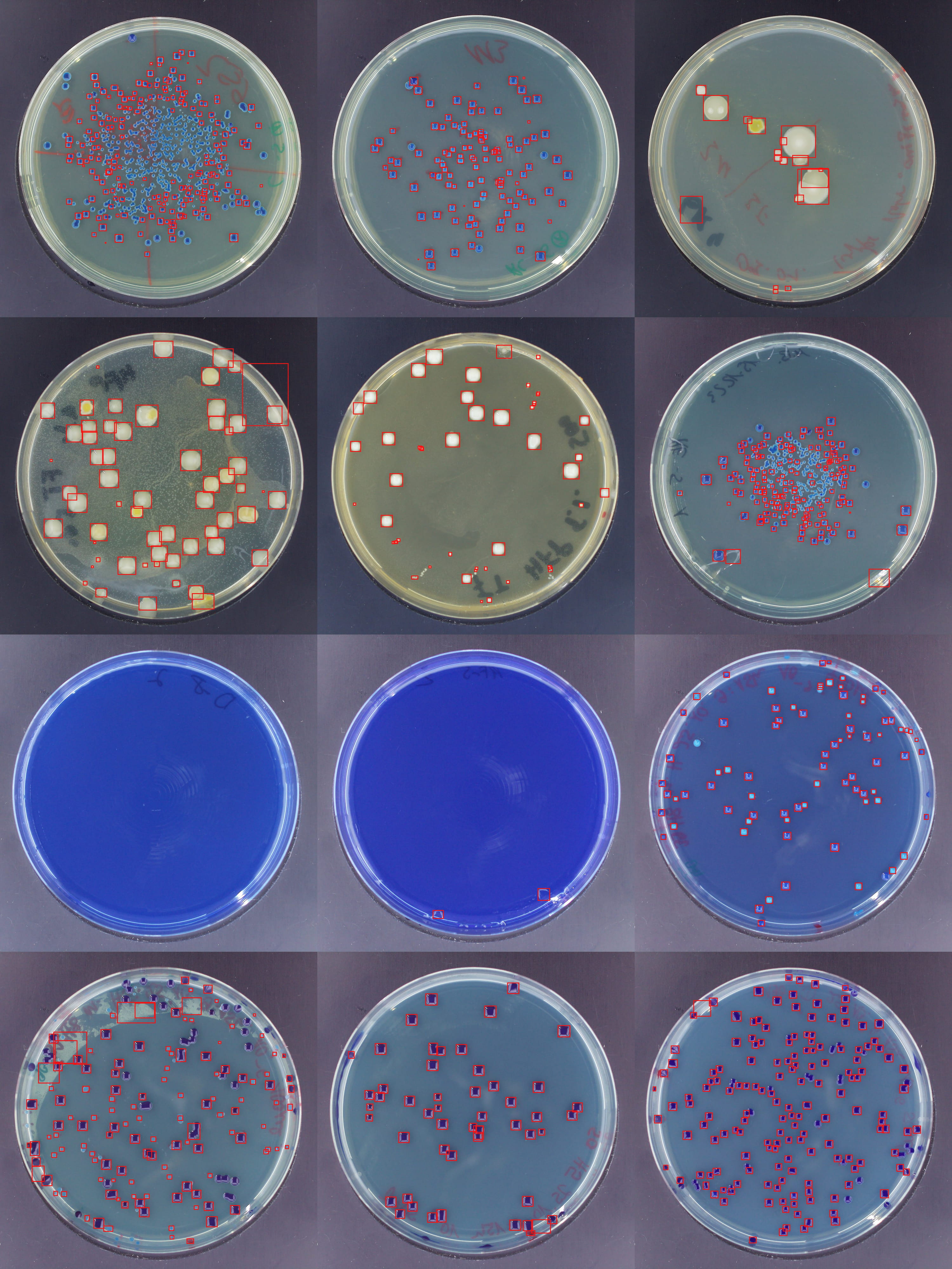 Examples of colony detection across various densities and shapes